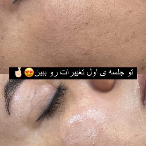 نیازمند مدل فیشال