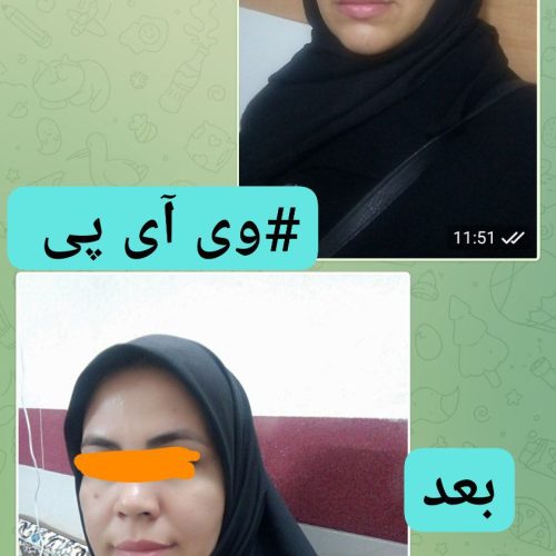 کرمvipاصل