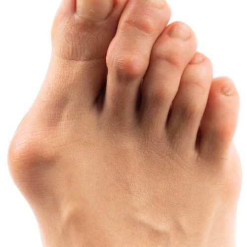 مشاوره رایگان بدای دردهای مفصلی و روماتیسم