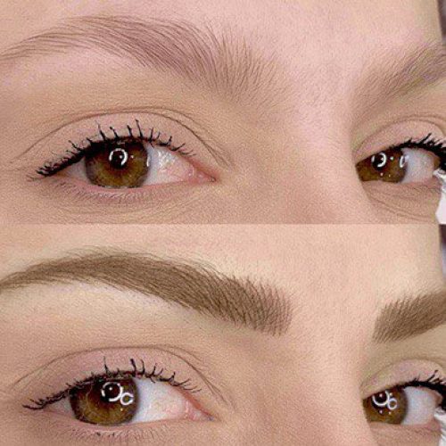 کاشت ابرو و مو