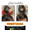 پک ریزش مو تضمینی بدون بازگشت