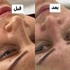 خدمات عیدانه فیشال وپاکسازی پوست همراه باآفرویژه