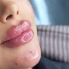 خدمات ارایشی و زیبایی پوست و مو وفیشیال مطب زیبایی