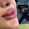 خدمات ارایشی و زیبایی پوست و مو وفیشیال مطب زیبایی