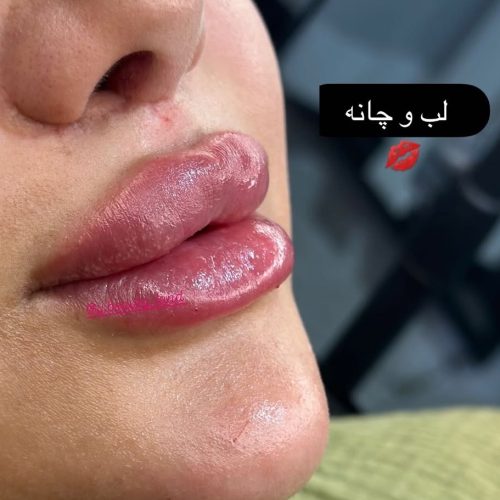 خدمات ارایشی و زیبایی پوست و مو وفیشیال مطب زیبایی
