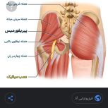 درمانگر ومشاوره دیسک وسیاتیک