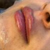 جشنواره 50درصدی فیشال،ژل و بوتاکس ،ریموو تتو صورت وبدن