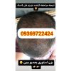 پک ریزش مو تضمینی بدون بازگشت