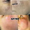 خدمات عیدانه فیشال وپاکسازی پوست همراه باآفرویژه