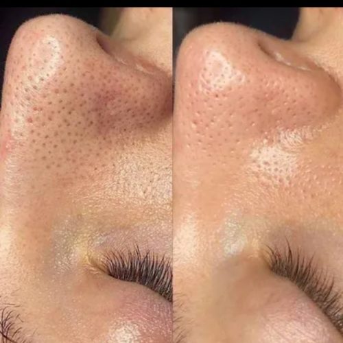 خدمات عیدانه فیشال وپاکسازی پوست همراه باآفرویژه