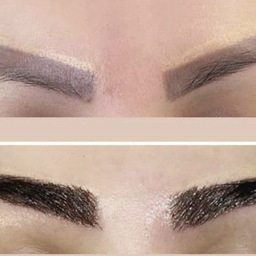 کاشت ابرو و مو