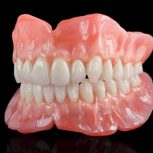 درمان بیماران بی دندان