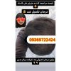 پک ریزش مو تضمینی بدون بازگشت