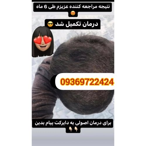پک ریزش مو تضمینی بدون بازگشت