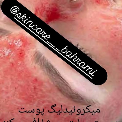 فیشیال تخصصی و پاکسازی (ویژه بانوان)