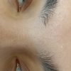 کاشت مژه و لیفت ابرو