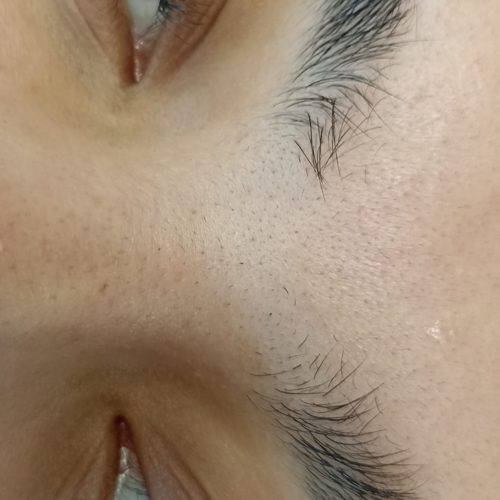 کاشت مژه و لیفت ابرو