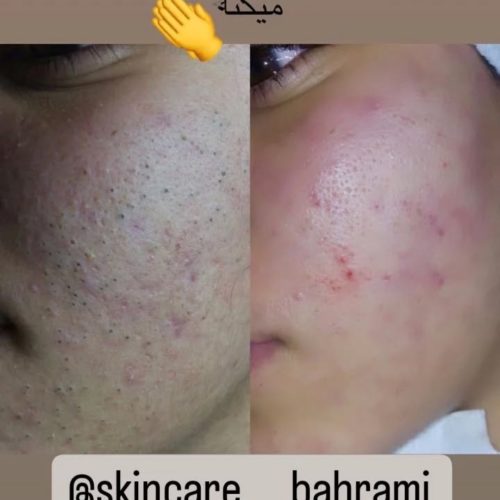فیشیال تخصصی و پاکسازی (ویژه بانوان)