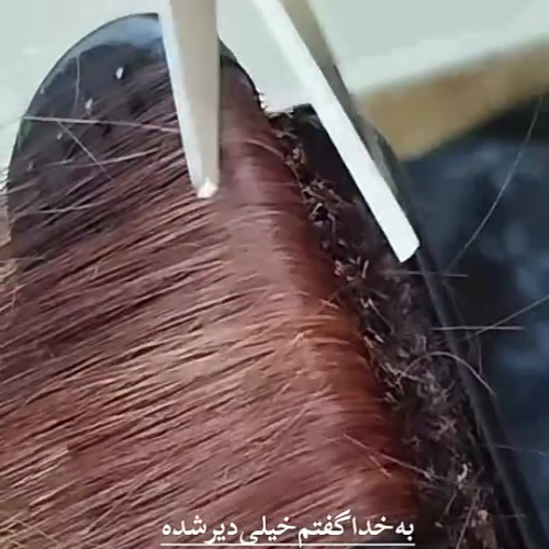 موخوره گیری مو