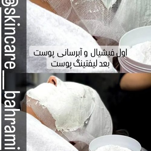 فیشیال تخصصی و پاکسازی (ویژه بانوان)