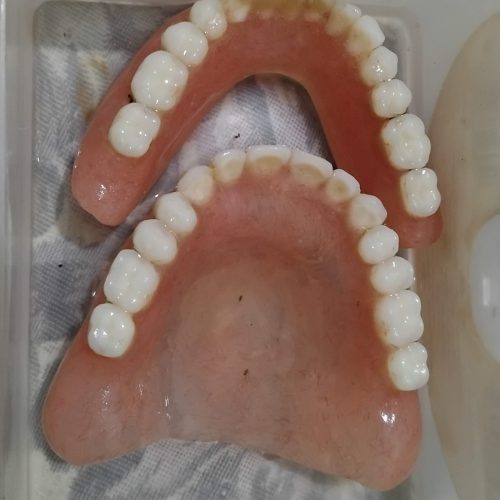 دندون مصنوعی دست نخورده