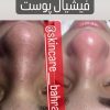 فیشیال تخصصی و پاکسازی (ویژه بانوان)