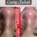 فیشیال تخصصی و پاکسازی (ویژه بانوان)