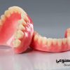 دندان مصنوعی کامل