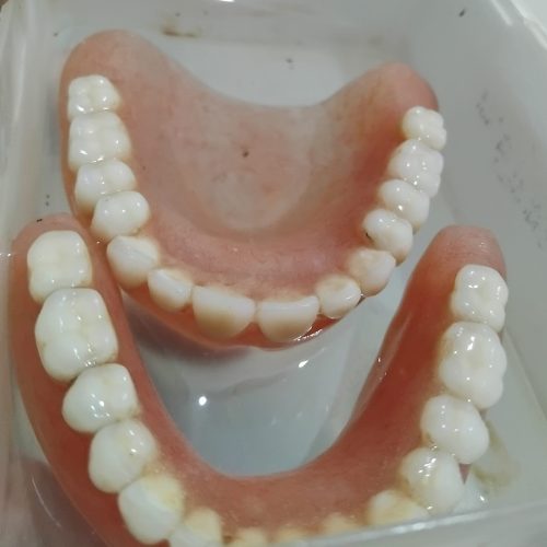 دندون مصنوعی دست نخورده