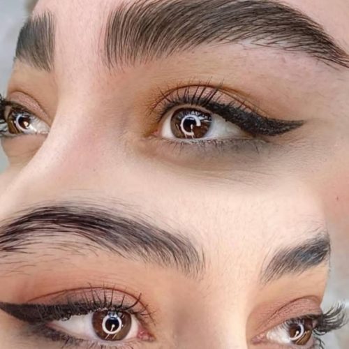 میکروبلیدینگ