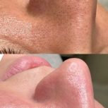 پاکسازی پوست