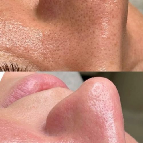 پاکسازی پوست