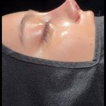 جراح زیبایی