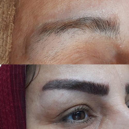 میکرو میکروبلیدینگ لیفت ابرو و مژه و بافت مو با قیمت استثنائی