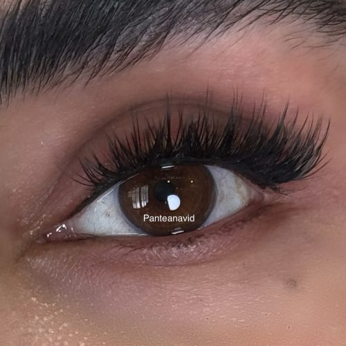 کاشت مژه ی هیدن