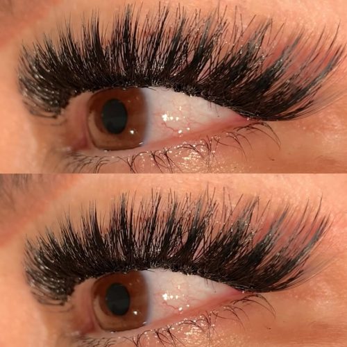 کاشت مژه ی هیدن