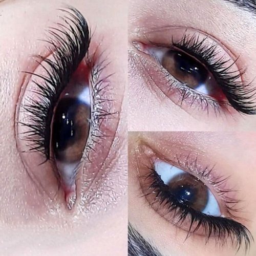 کاشت مژه ی هیدن