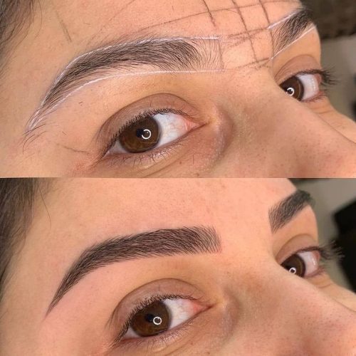 میکروبلیدینگ فیبروز شیدینگ لب بنمژه رایگان