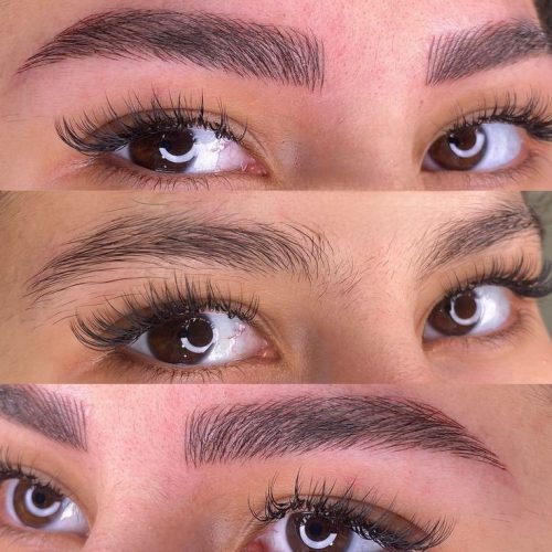 میکروبلیدینگ فیبروز شیدینگ لب بنمژه رایگان