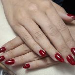 مدل کاشت پلی ژل