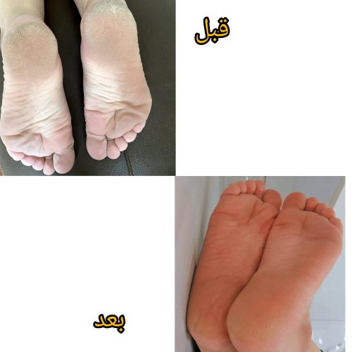 ناخنکار