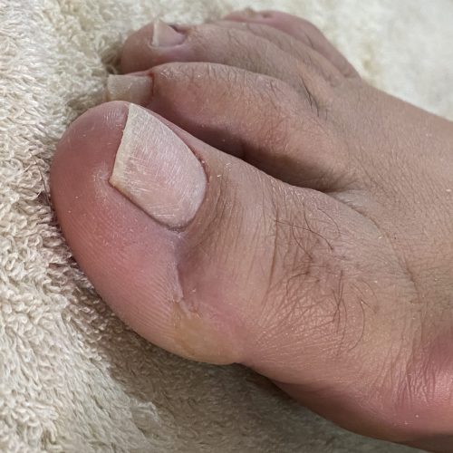 خدمات ناخن و پدیکور درمانی و آموزش