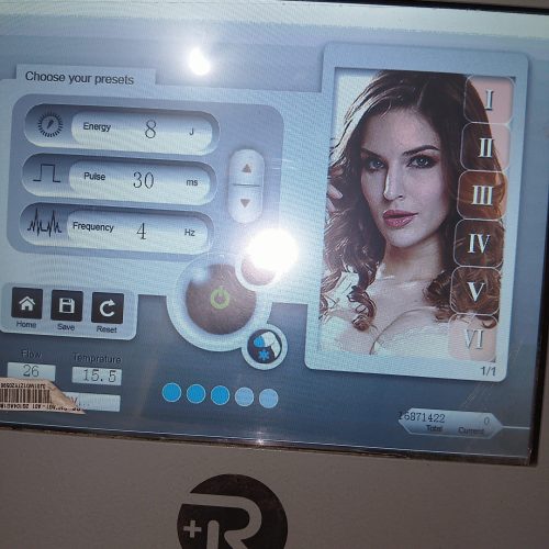 دستگاه لیزر رادو