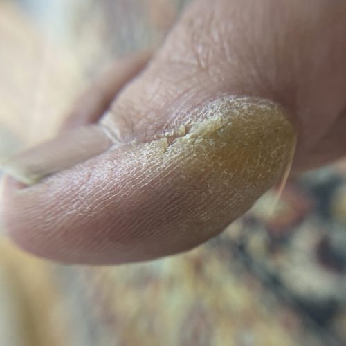 خدمات ناخن و پدیکور درمانی و آموزش