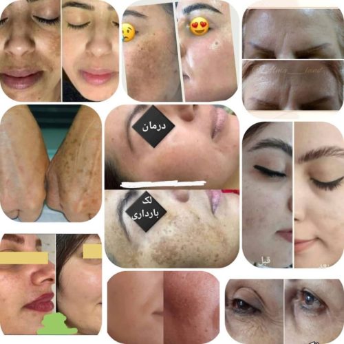 روغن های ارگانیک وباکنپرس سردوعالی