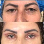 اف ژل و بوتاکس فیلر و تزریق چربی وخدمات دیگر