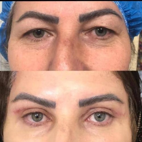 اف ژل و بوتاکس فیلر و تزریق چربی وخدمات دیگر