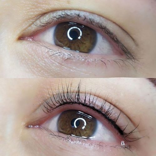 میکروبلیدینگ فیبروز شیدینگ لب بنمژه رایگان