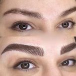 میکروبلیدینگ