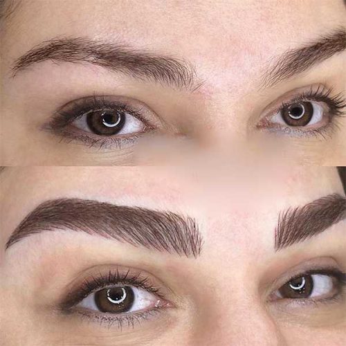 میکروبلیدینگ